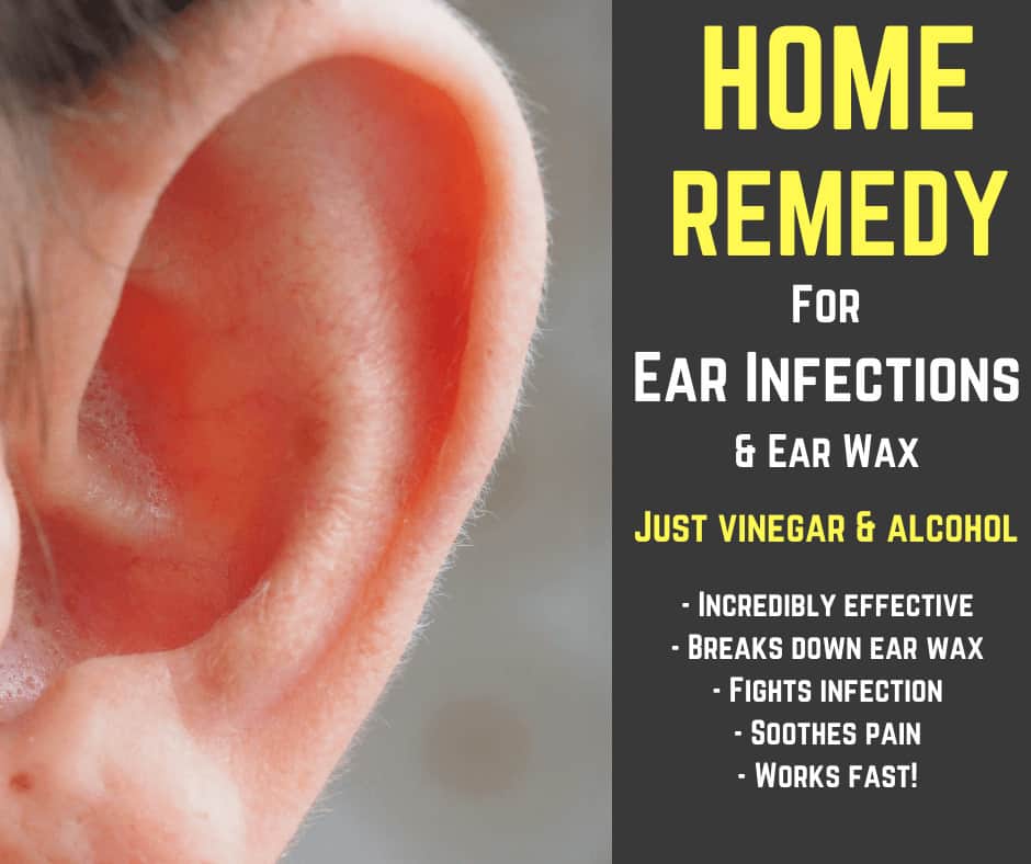 Home Remedy For Earwax And Ear Infections