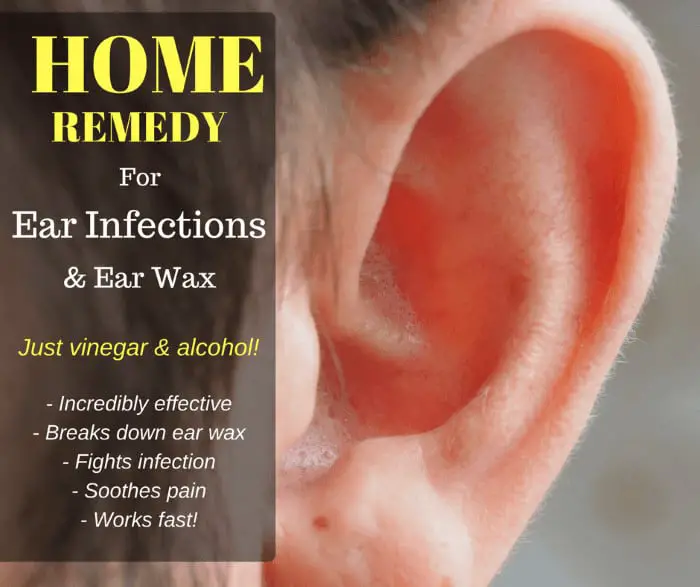 Home Remedy For Earwax And Ear Infections