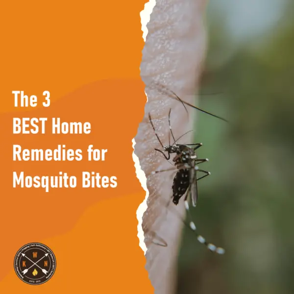 The 3 BEST Home Remedies for Mosquito Bites for facebook