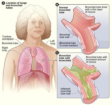 chest congestion symptoms