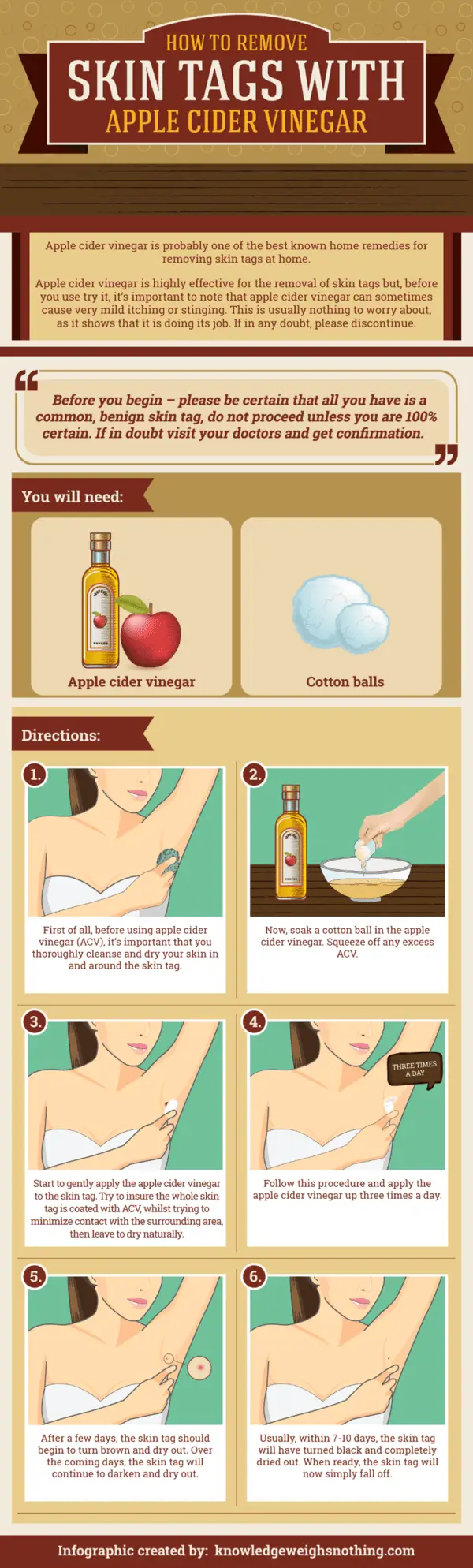 How to remove skin tags infographic
